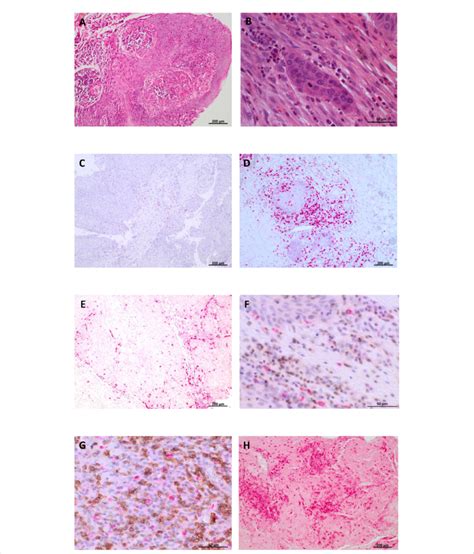 Immunohistochemical Analysis Of Immune Cell Subsets In The Validation