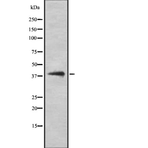 HLA Class I Polyclonal Antibody Invitrogen 100 μL Unconjugated Ver