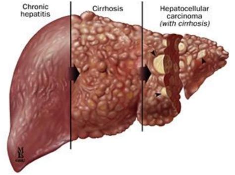 Infection And Immunity Session Nine Viral Infections Of The Gut