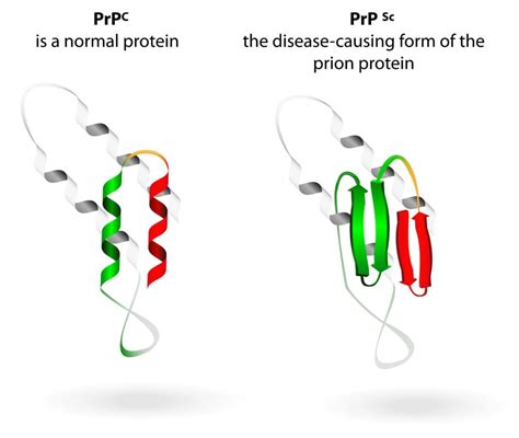 Frightening Facts About The Mysterious Deadly Prion Diseases Listverse