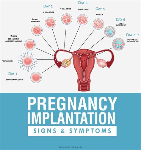 The 25+ best Implantation symptoms ideas on Pinterest | Implantation ...