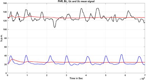 Fhr Signal And Uterine Contractions Full Size Doi Download Scientific Diagram