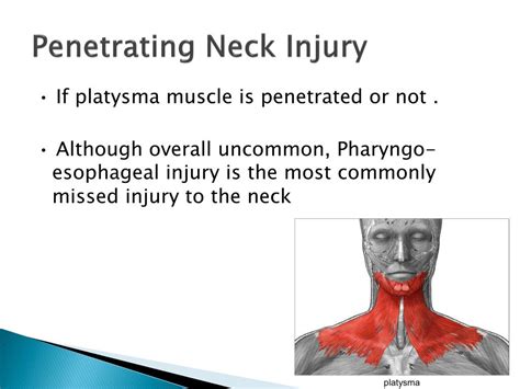 Ppt Neck Trauma Powerpoint Presentation Free Download Id 2206077