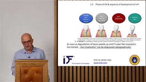 Prof Dr Stefan Ihde On Periimplantitis International Implant