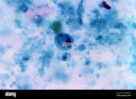 This Photomicrograph Of A Trichrome Stained Specimen Revealed Some Of The Ultrastructural