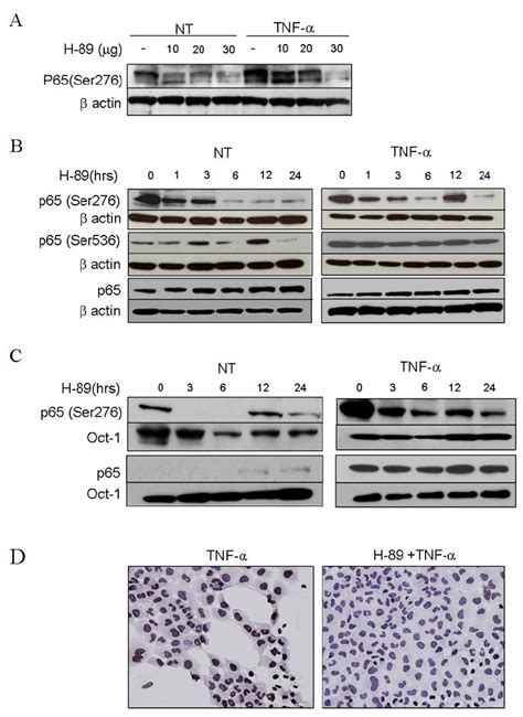 PKA Inhibitor H 89 Blocks Formation Of Phospho P65 Ser276 Without