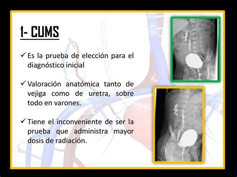 Reflujo Vesicoureteral Ppt Descargar