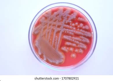 Bacillus Cereus Colony Morphology On Blood Stockfoto