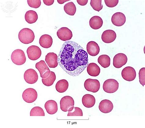 Monocyte Diagram | Quizlet