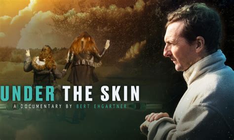 Under The Skin Documentary Epochtv