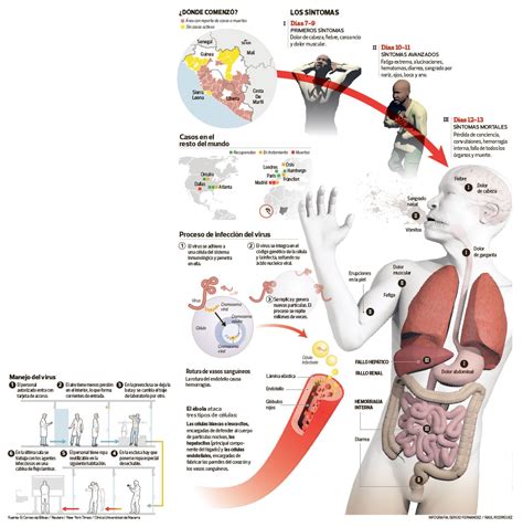 InfografÍa Así Actúa El ébola En El Cuerpo Humano Medicina