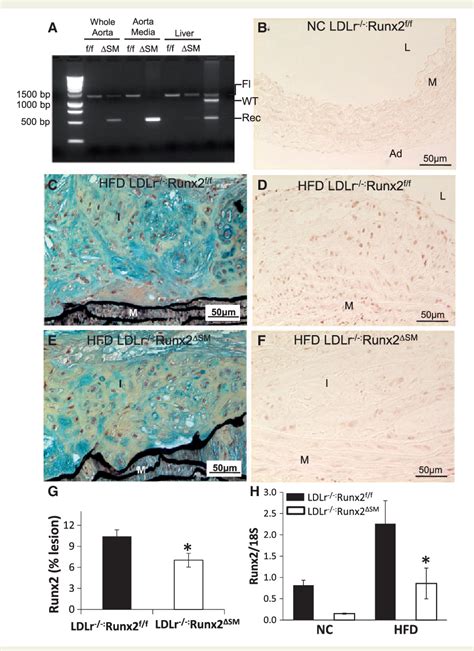 Figure 1 From Runx2 Deletion In Smooth Muscle Cells Inhibits Vascular