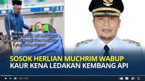 Sosok Herlian Muchrim Wabup Kaur Bengkulu Alami Insiden Jari Tangan