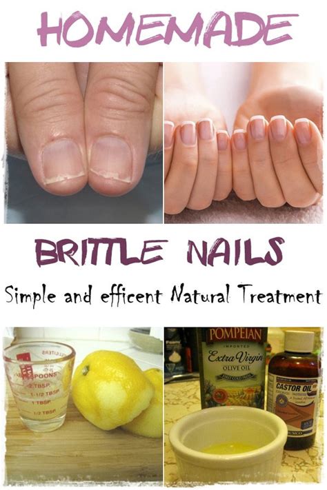 Brittle Nails Everything In One Place