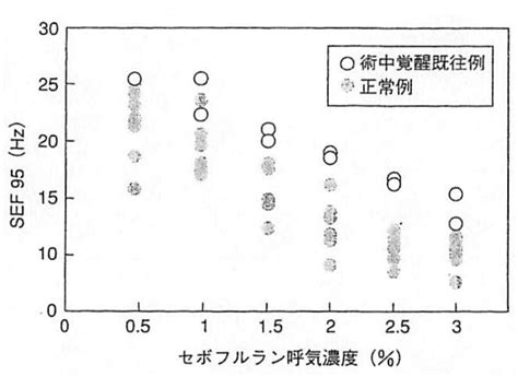 BIS | 麻酔科1年生