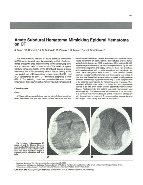 Acute Subdural Hematoma Mimicking Epidural Hematoma Onct DocsLib