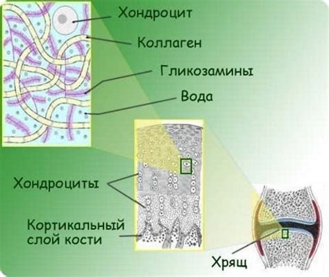 Остеофіти колінного суглоба
