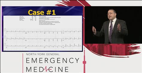 Emu365 Amal Mattu On Killer Ecgs And Pericardial Effusions Emergency