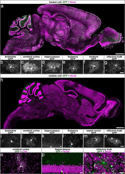 Conditional Deletion Of Vgat With Ascl1 Creer Occurs In Extracerebellar