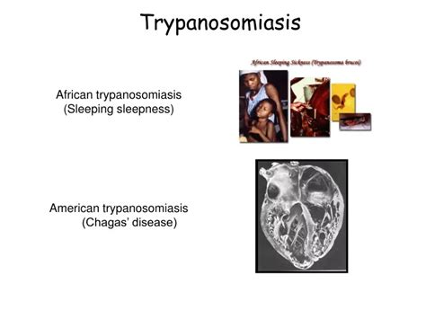 Ppt Trypanosomiasis Powerpoint Presentation Free Download Id9415294