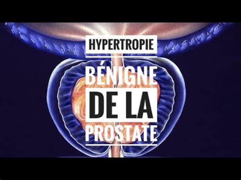 Hypertrophie B Nigne De La Prostate Partie Introduction