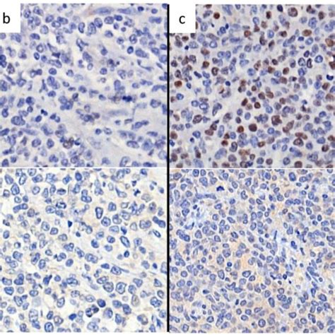 Representative Figures Of Nuclear Staining Patterns Of Bcl 6 And Peli1