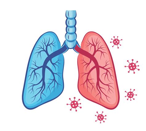 Využití extrakorporální membránové oxygenace ECMO proLékaře cz