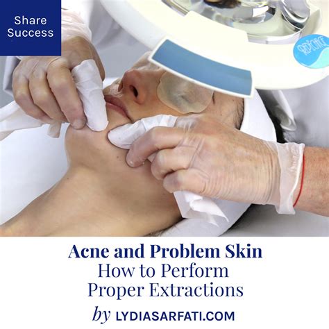 Acne And Problem Skin How To Perform Extractions Lydia Sarfati