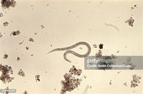 Worms Under Microscope Photos And Premium High Res Pictures Getty Images