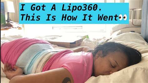 My Lipo 360 Surgery Youtube