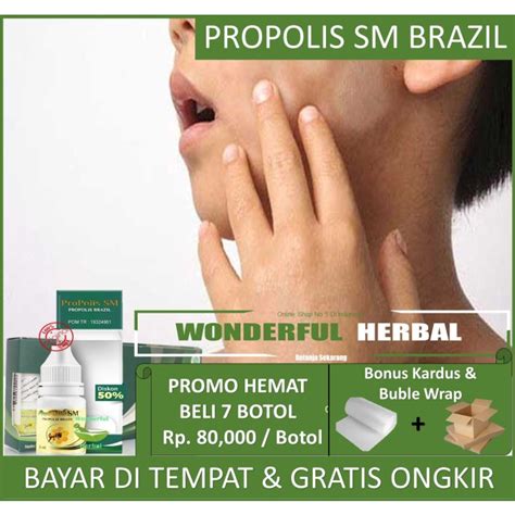 Jual PROM0 Obat Penghilang Panu Hapuran Di Tubuh Alami Propolis