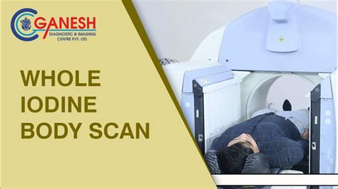 Whole Iodine Body Scan Test Purpose Preparation And Complete Procedure