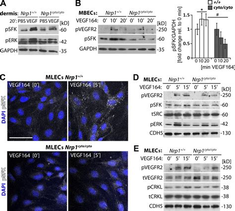 Vegf165 Induced Vascular Permeability Requires Nrp1 For Abl Mediated