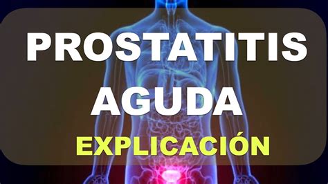 Prostatitis aguda Inflamación de la próstata Síntomas YouTube