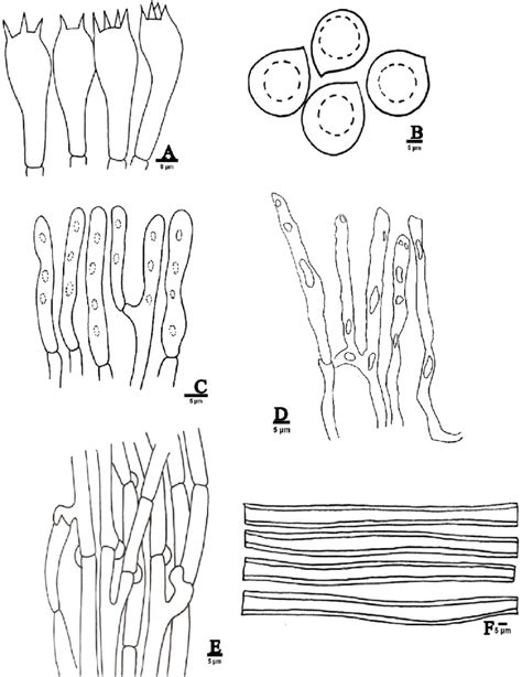 Scypha Diagram