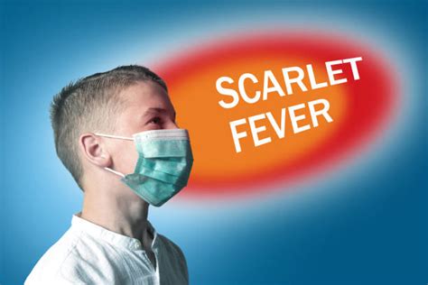 20 Scarlet Fever Child Stock Photos Pictures And Royalty Free Images