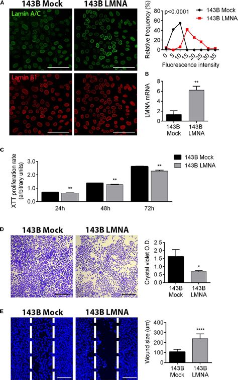 Frontiers Lamin A C Mechanosensor Drives Tumor Cell Aggressiveness