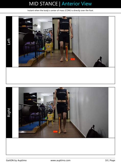 Semi Automatic Gait Analysis System For Medical Diagnostic At Best