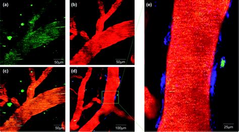 Differentiating A And A In Amyloid Plaques With A Small Molecule