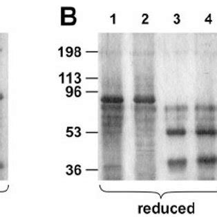 Sds Page Of Recombinant Wild Type And Ser Fxi And Fxia