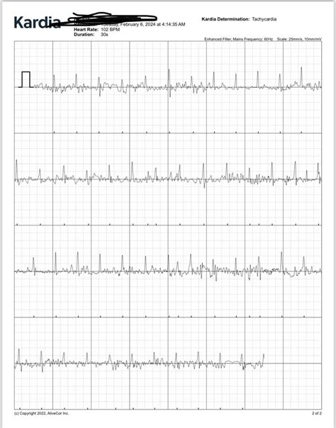 Afib Or Artificial Rafib