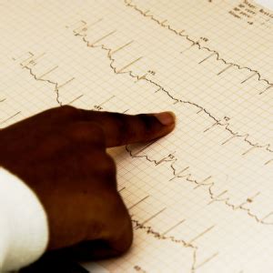 EKG Technician Training In CT Training Direct