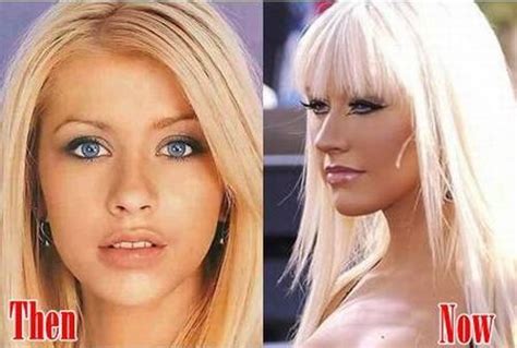 Christina Aguilera Plastic Surgery Secrets Boob Job Lip Fillers