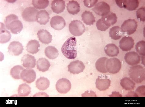 Microfotografía De Un Compacto Creciente Trofozoitos De Plasmodium Vivax Parásitos Causantes