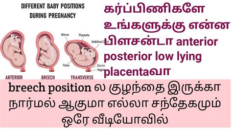 Anterior Posterior Low Lying Placenta Baby Position Full Detail Low