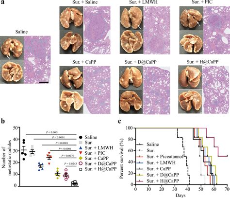 Hcapp Combined With Surgery Resection Achieved The Anti Metastasis