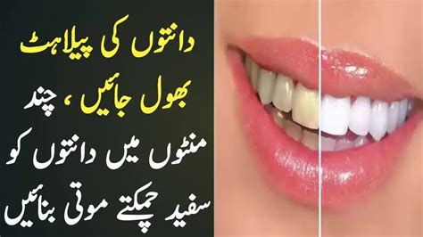 Daant Ke Peelahat Door Krny Ka Totka Whiten Yellow Teeth Fast Youtube