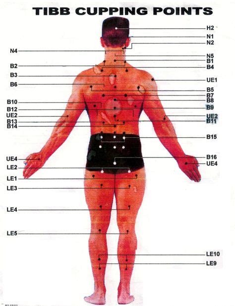 90 Cupping Therapy Ideas In 2020 Cupping Therapy Hijama Therapy