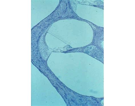 Organ of Corti Histology Quiz