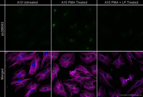 Anti ERK1 Phospho T202 Y204 ERK2 Phospho T185 Y187 Antibody